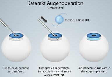Augenarzt Dr. med. Claudius Lachmann